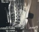 ヘルニアなど、脊椎の病気、自身で治せます 脊椎に病気を抱えている方々、自分自身の力で治せます。 イメージ1