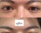 有料級セルフ小顔矯正教えます 小顔矯正は整体にいかなくても充分に5分のセルフケアで行えます イメージ1