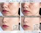 美容クリニック経験者｜人物レタッチ承ります ご希望に合わせてナチュラル〜しっかり補正まで対応 イメージ2