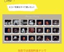 世界に一つだけのエコーアルバムを作ります お腹の中から始まる家族の物語を、永遠に残すお手伝いをします。 イメージ5