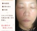 肌悩み改善 あなただけのスキンケアアドバイスします すっぴんに自信を持ちたい方へ あなただけのケア方法をご提案 イメージ2