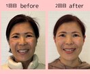 理想のお顔にデザイン、あなたの魅力を引き出します 正しい表情筋の使い方を知り日常に落とし込み、別人級に変化 イメージ2