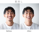 部分レタッチ・修正致します ここさえ良ければな……。を解決いたします♪ イメージ3