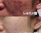 最近の美肌術を教えます あなたの肌に1番適した化粧品、お手入れ方法を教えます！ イメージ1