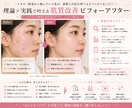 肌質に合わせた最適ケアを提案します 今のスキンケアが合ってるかを一つずつチェックします！ イメージ2
