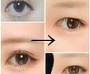 奥二重から二重になる方法教えます 二重幅に不満があり幅を広げたい方へ イメージ1