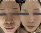 男性必見！かっこよくします 【今流行り】オンラインエステでかっこよく綺麗に！ イメージ3