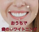 歯のホワイトニング、おうちで気軽にできます 黄ばみが気になる方！！おうちでもホワイトニング可能です！ イメージ1