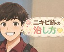 ニキビ跡（クレーター肌）の治療法教えます ポテンツァ10回で失敗。101万投じてわかった1つのやり方 イメージ1