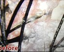 薬に頼らない薄毛・抜け毛・AGA対策を伝えます AGA・FAGA  10000回頭皮を診たプロが解説します！ イメージ3