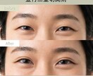 現役看護師>>>美容医療専門インスタ運用代行します SNS運用/集客・採用/アカウント設計/投稿企画・制作/分析 イメージ3
