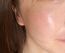 あなたのお悩みに合ったスキンケア★一緒に考えます ◎お悩みを改善して美肌になるためのスキンケアを一緒に考えます イメージ1