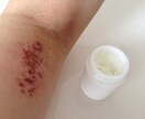 アレルギー克服体験からアトピーの治し方を提供します 薬を使わず、原因は何か。常識を疑い・食生活改善を提案します。 イメージ1