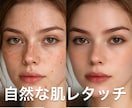 自然な肌レタッチ・ニキビや肌荒れを修正ます 満足いただけるまで無料で対応いたします イメージ6