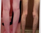 摂食障害の解決に導きます 摂食障害乗り越えたメディアで有名カウンセラー全力サポート！ イメージ3