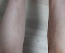 剛毛の方でも綺麗に脱毛できます 半額でできます。3カ月に1回くらいで通えばオッケーです。 イメージ1