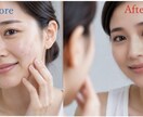 美肌★大切なお写真をレタッチします 一生に一度の素敵な瞬間、必要な分だけ、ナチュラル・大胆に イメージ1