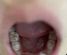 お子さんの歯の悩み歯並び、矯正について相談乗ります 子供の歯並び子供の歯の矯正虫歯 お悩み イメージ1
