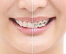 子供の矯正・大人の矯正、歯並びについておしえます お久しぶりです。最近どうですか？ イメージ1