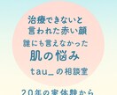 酒さ・敏感肌の悩み、実体験からお話をお聞きします その悩み、誰かに話すだけで、少し楽になるかもしれません イメージ2