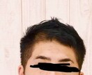 4年経過した【AGA治療】の経験談お話します 30歳でまさか薄くなるとは・・・お悩み共感します。 イメージ2