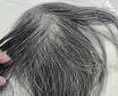カツラ,ウイッグの相談にのります 薄毛でお悩みの方！予算こだわりを伺って最適な方法を伝えます！ イメージ3