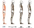 国家資格持った治療家が専用の骨格の歪み分析します 体型の気になるママ・背中が丸い・足が開いたあなた必見 イメージ3
