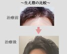 薄毛に悩む方に！薄毛対策教えます 〜思ってたよりも安く薄毛対策出来ます〜 イメージ2