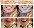 歯並び黄ばみの補正で好印象な笑顔画像に仕上げます まずはご相談ください！丁寧な対応心がけます イメージ1