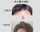大手発毛クリニックはまだ止めて！薄毛治療法教えます 〜大手発毛クリニックはこの格安薄毛治療法を試してから〜 イメージ2