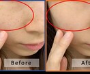 お写真の、「ほくろ」・「しみ」けします 気になる「ほくろ」「しみ」「イボ」を消して美しい写真にします イメージ2