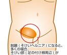 そけいヘルニアに関するご相談に専門医がお答えします 手術数5000件以上の実績から患者さん目線で親身に対応します イメージ1