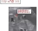 専門医が赤ちゃんの性別予測とエコーの解説をします ベビーナブ対応！11週以降のエコーであれば判定します。 イメージ7