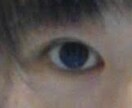 あなたの瞼にぴったりの二重にする方法を教えます テープか、のりか…どの方法がいいの？写真で診断できます！ イメージ2