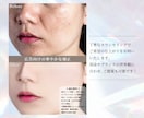 美容クリニック経験者｜人物レタッチ承ります ご希望に合わせてナチュラル〜しっかり補正まで対応 イメージ3