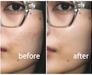 プロの技で肌をレタッチします 気になる肌ををナチュラルに編集！！ イメージ1