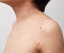 アレルギー克服体験からアトピーの治し方を提供します 薬を使わず、原因は何か。常識を疑い・食生活改善を提案します。 イメージ8