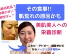 アトピー・ニキビ・敏感肌＊美肌への栄養診断をします 栄養不足が原因かも☆美容迷子から分子栄養学で美肌へ イメージ1