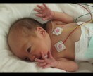 25週・超低出生体重児2人育てた経験からお話聞ます NICU後、発達、障害、きょうだい育児まで経験しています イメージ1