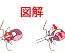 現役歯科衛生士がゆる可愛い医療イラストをお描きます パワポや院内の資料にゆるいイラストを入れて可愛さアップ！ イメージ10