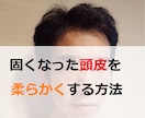 薄毛予防！固い頭皮を柔らかくする方法教えます 頭皮が固い人は必見です。頭皮がみるみる柔らかくなります イメージ1
