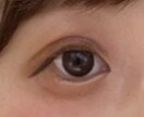 あなたの瞼にぴったりの二重にする方法を教えます テープか、のりか…どの方法がいいの？写真で診断できます！ イメージ1