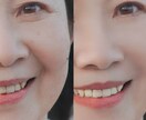 人物レタッチのプロが、あなたの写真を若返らせます シミ取り・たるみ取り・赤み取り・ホワイトニング・肌磨き イメージ3