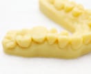 歯科用のみ　3Dプリンターで歯科模型を出力します 3Dプリンターがなくて困ってる方をお手伝いします イメージ7