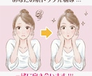 男女OK！この肌トラブルの原因と対処法を伝授します ～マスクを外しても恥ずかしくない自分になりたい方へ～ イメージ5
