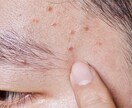 ｌ男性専用ｌあなたの肌に最適なスキンケア　教えます 『清潔×透明』な肌へ、ビデオミーティングで肌診断！ イメージ3