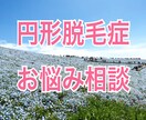 円形脱毛症のお悩み相談⭐︎四柱推命鑑定もします 円形脱毛症でも楽しく生活できるよう、お手伝いさせてください イメージ1