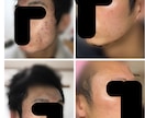 現役美容看護師が美肌のための提案をします 数十万の契約で後悔する前に！現役看護師が中立にアドバイス イメージ1