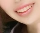 リップモデルやります ピアスがあるので個性的です外して跡が分からないようにも可能 イメージ4