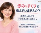酒さ・敏感肌の悩み、実体験からお話をお聞きします その悩み、誰かに話すだけで、少し楽になるかもしれません イメージ1